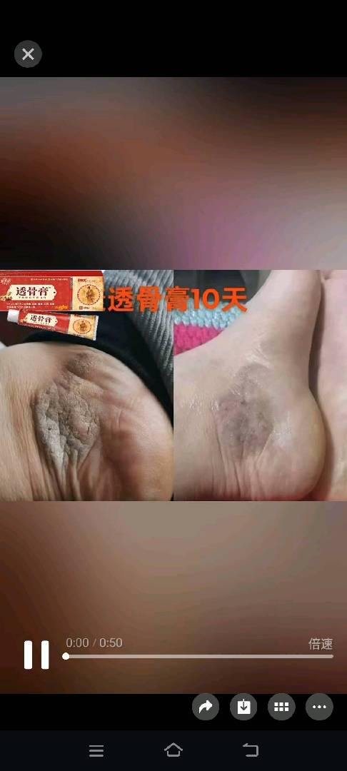 透骨膏（祖传御医宫庭秘方） 图片