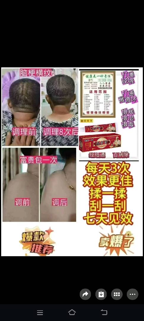 透骨膏（祖传御医宫庭秘方） 图片