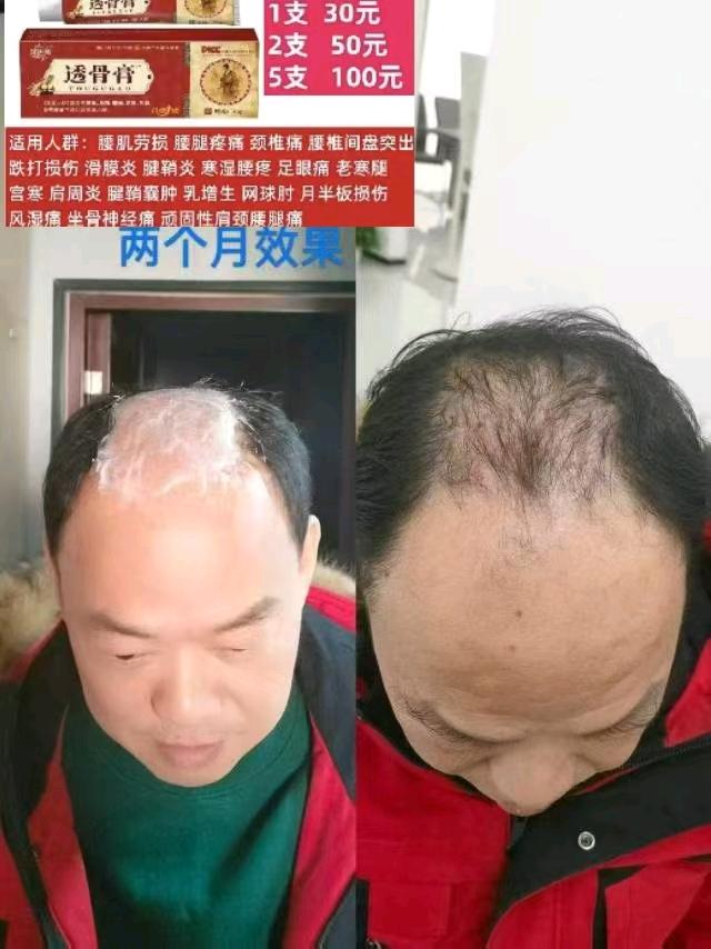 兼职自由通山免费试用一次 图片