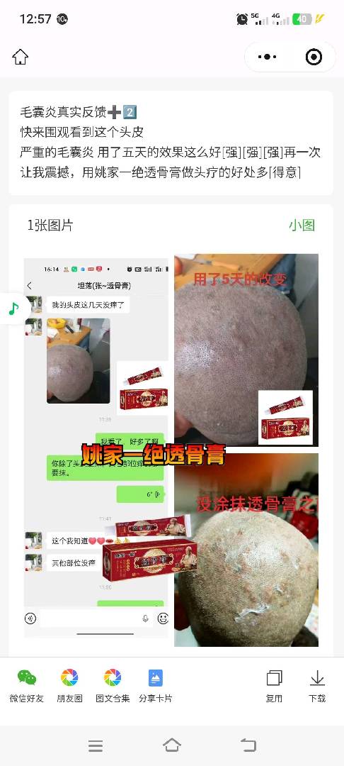 兼职(视频为珠海朋友兼职透骨膏) 图片