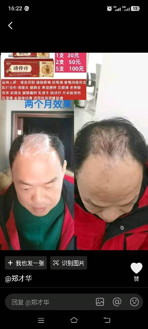 大量招人，注册5元，无本赚钱路 图片