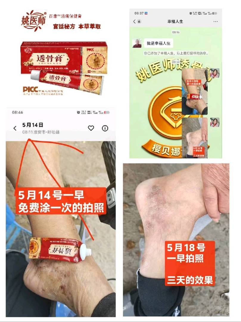 半夜疼到脸肿，靠姚家一绝透骨膏救命 太多的普通者亲测有效，信 图片
