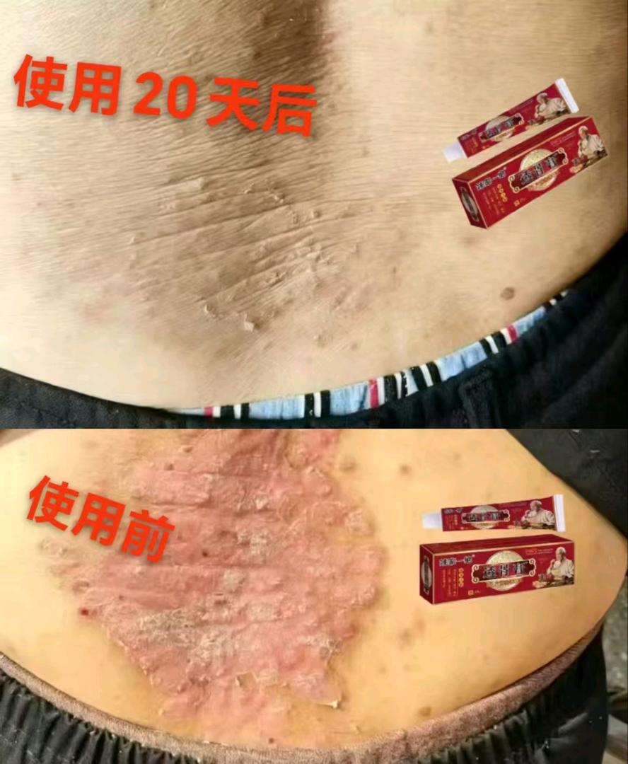 酸,麻,肿,胀,痛,痒?哪里需要抹哪里,使用方法 姚家一绝透 图片