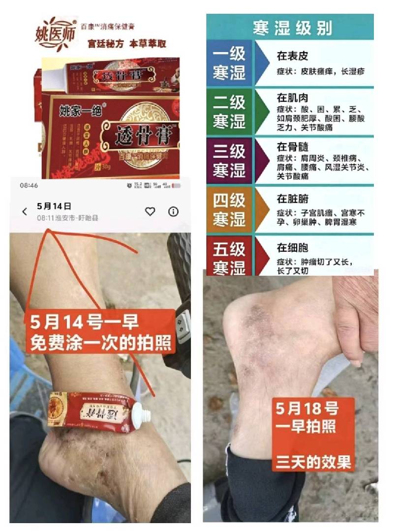痛的免费试一次见效!!听听我们群里昨天王姐的真实反馈,骨质增 图片