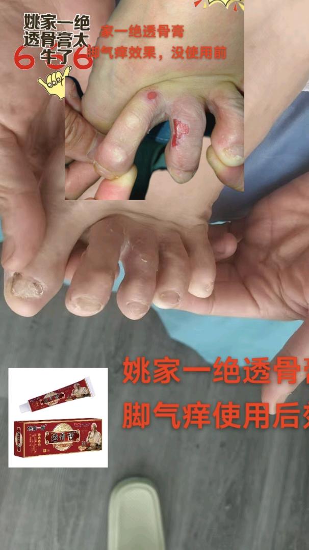 我每天做头疗，肩颈，整个腰腹部，臀部，用的感觉脂肪也燃烧了， 图片