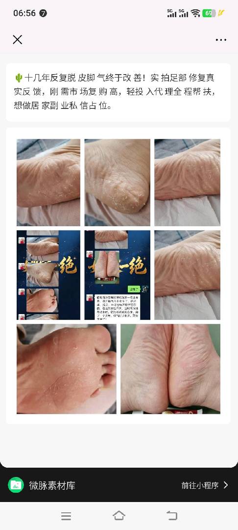 各种不适，涂一涂，抹一抹 图片